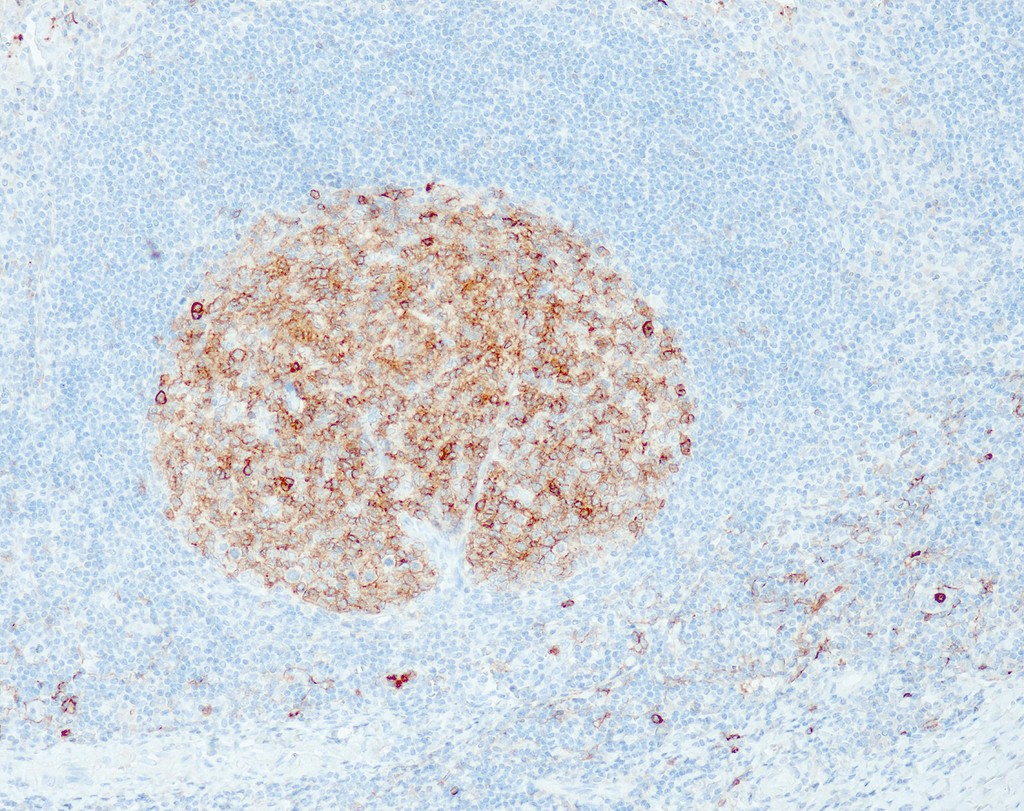CD10 (QR021) Rb 3 ml RTU liuos