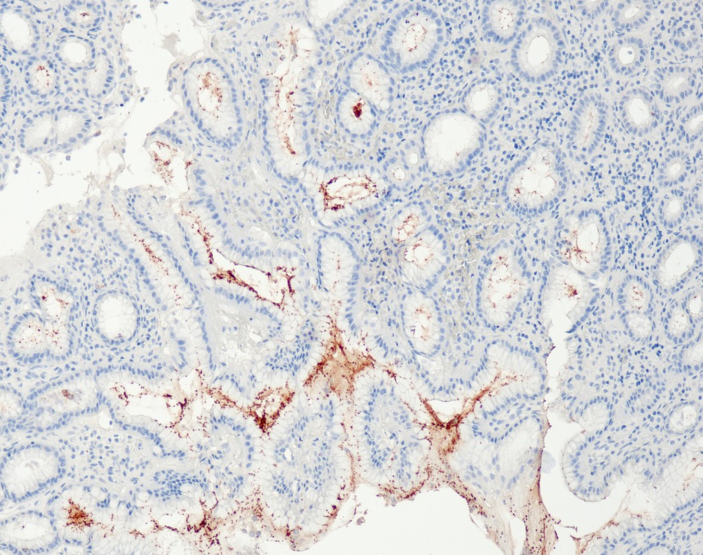 Helicobacter pylori (QR091) Rb 0,1 ml konsentraatti