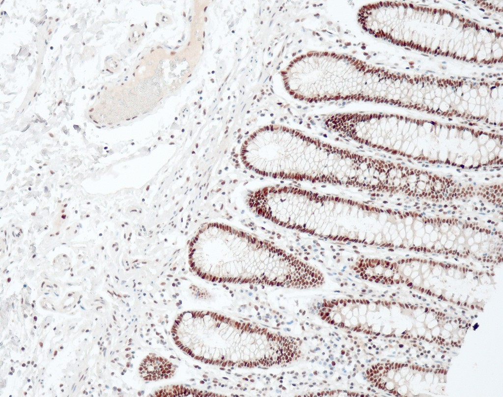 MLH1 (QM003) Ms 0,5 ml konsentraatti