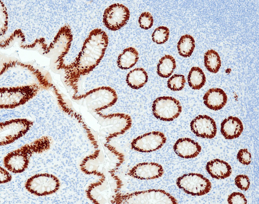 CDX2 (QR045) Rb 3 ml RTU liuos
