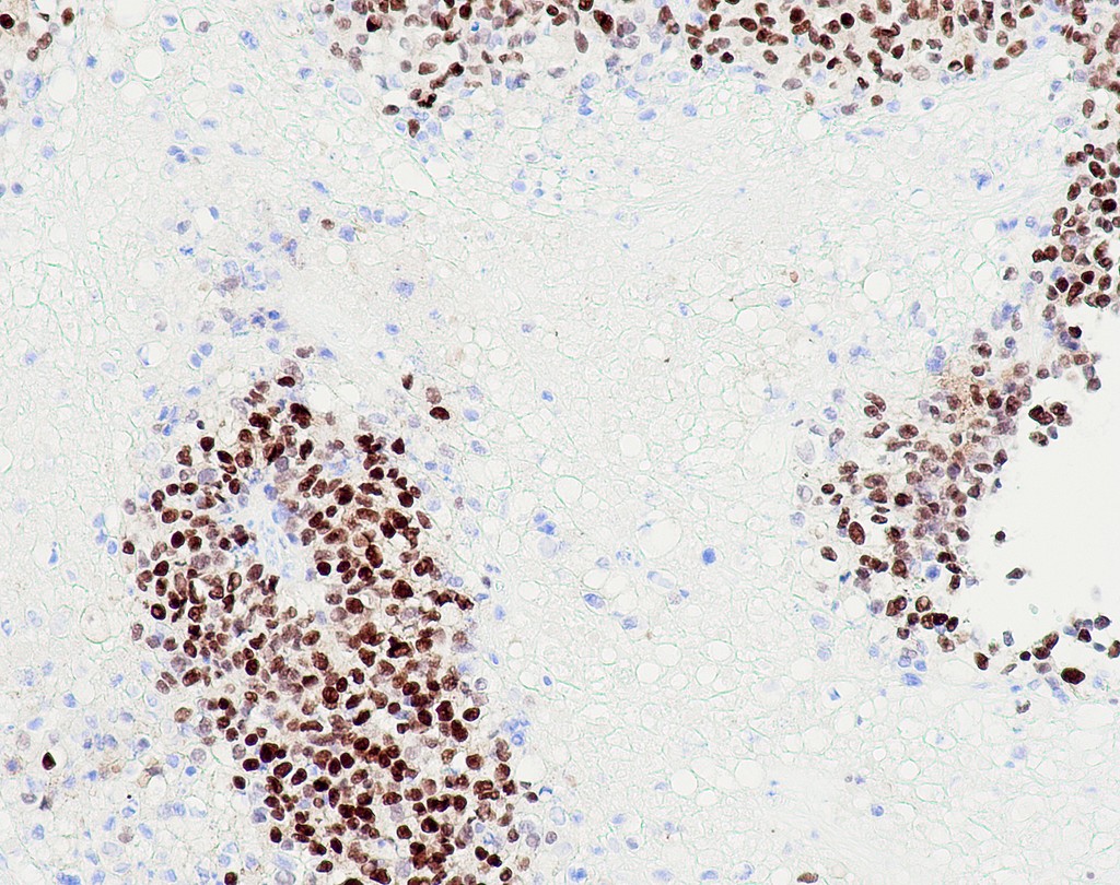 GATA3 (QR018) Rb 3 ml RTU liuos