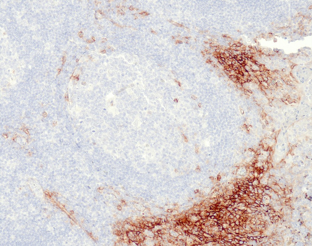 CD138 (QR102) Rb 1,0 ml konsentraatti