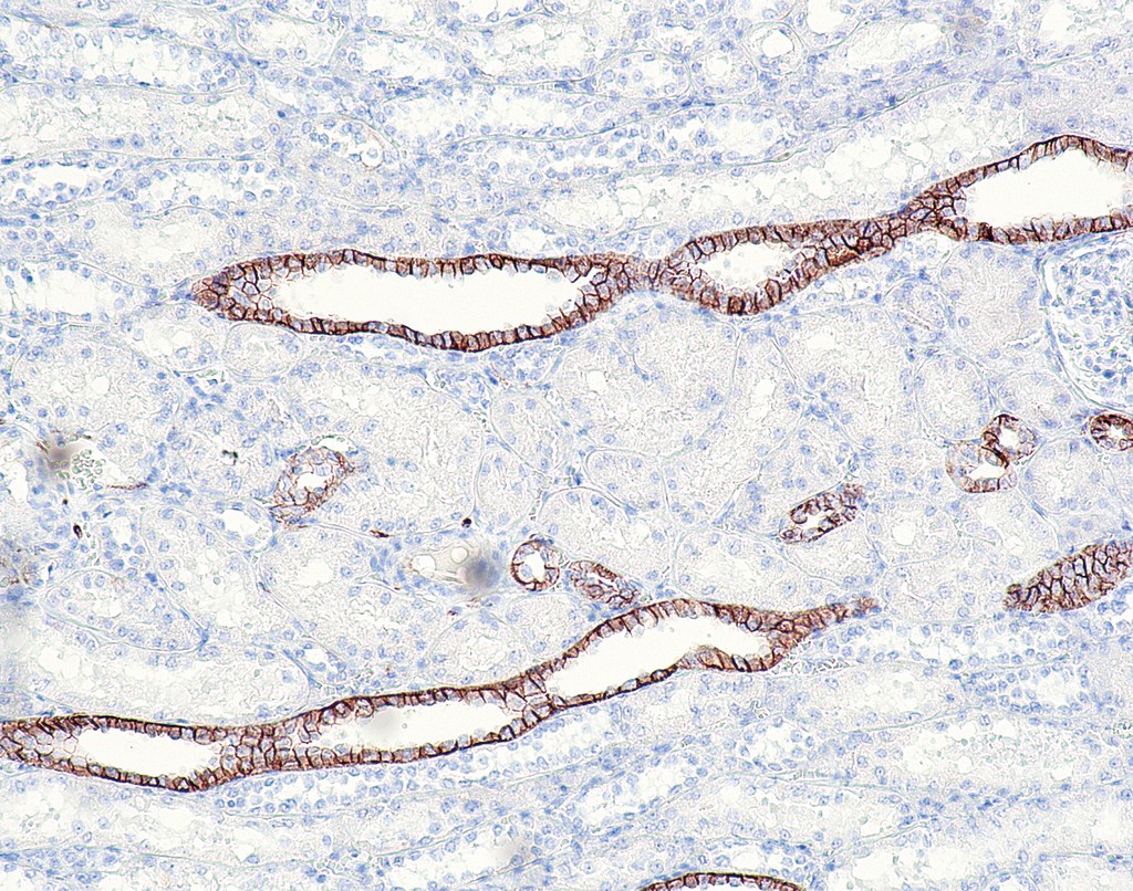CD171/L1CAM (QR039) Rb 1,0 ml konsentraatti