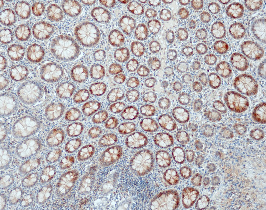 CDK4 (QR115) Rb 3 ml RTU liuos