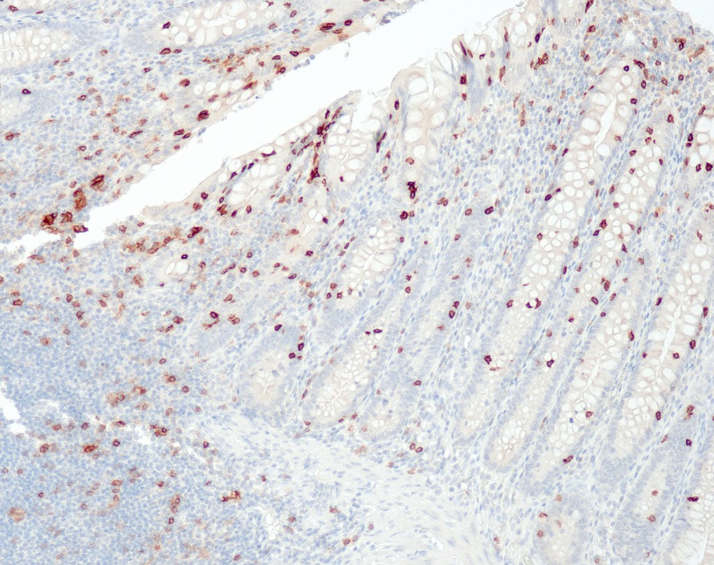 CD103 (QR081) Rb 3 ml RTU liuos
