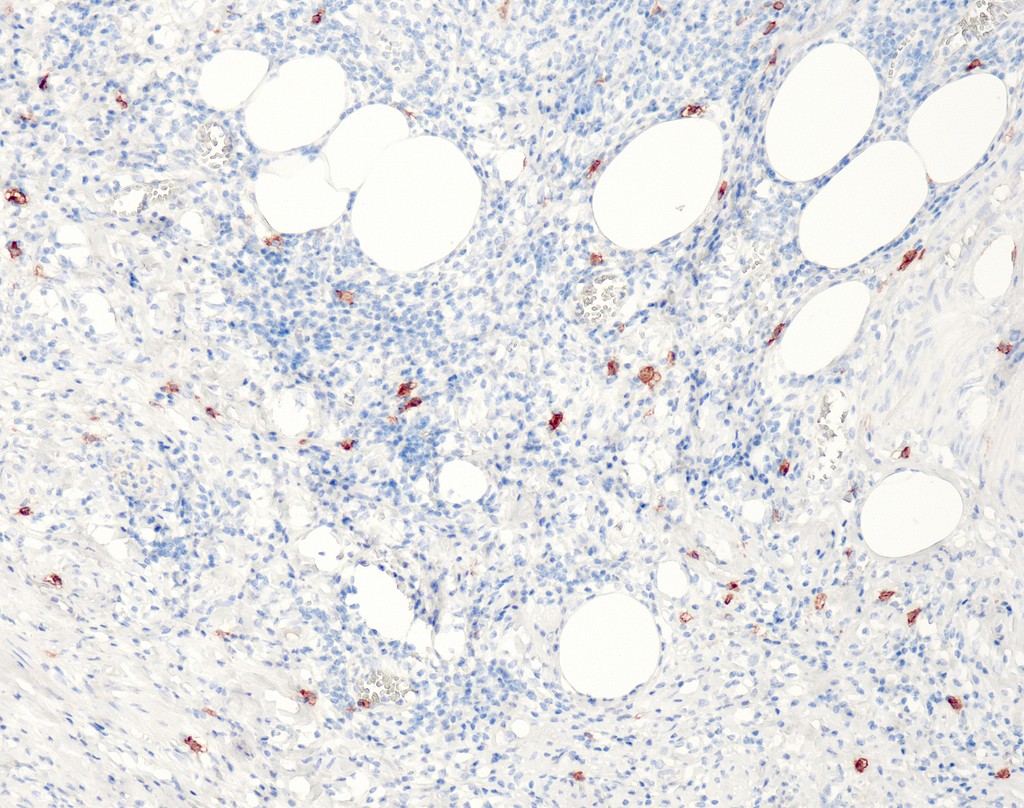 CD117 (QR012) Rb 3 ml RTU liuos