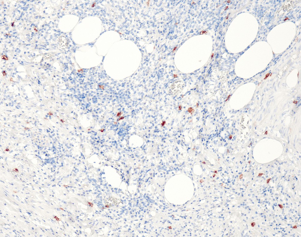 CD117 (QR012) Rb 7 ml RTU