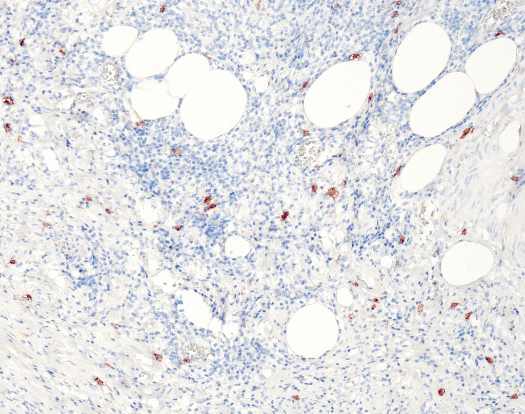 CD117 (QR012) Rb 15 ml RTU