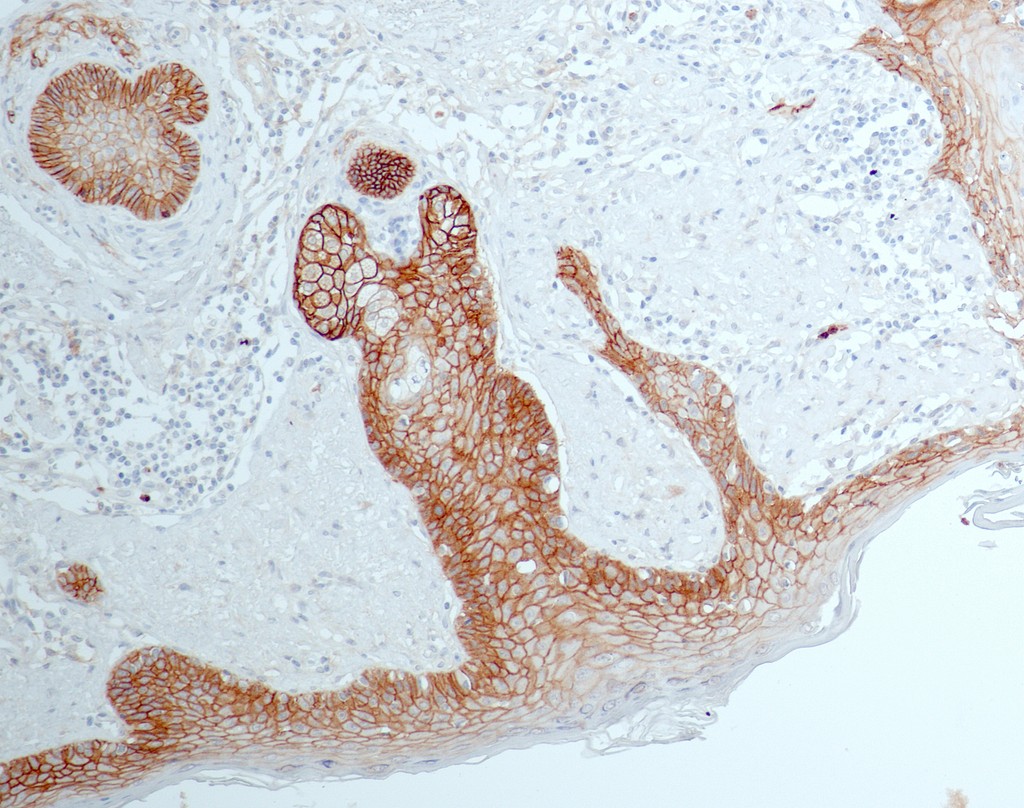 EGFR (QR078) Rb 7 ml RTU liuos