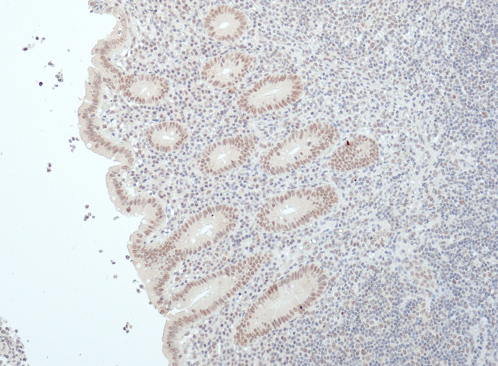 BAP1 (QR119) Rb 3 ml RTU liuos (Research Use Only)