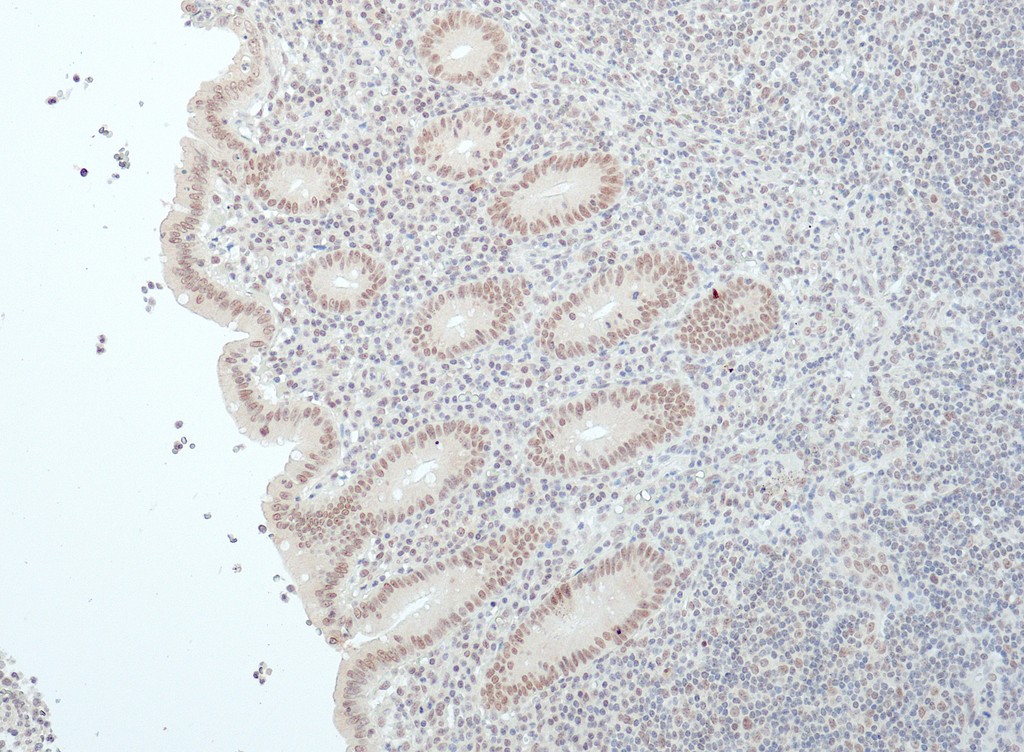 BAP1 (QR119) Rb 7 ml RTU liuos (Research Use Only)