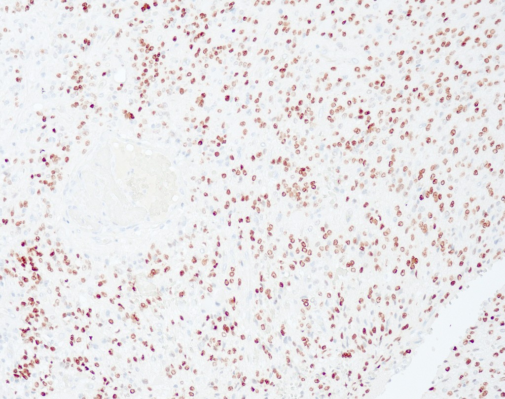 Olig2 (QR071) Rb 0.1 ml konsentraatti