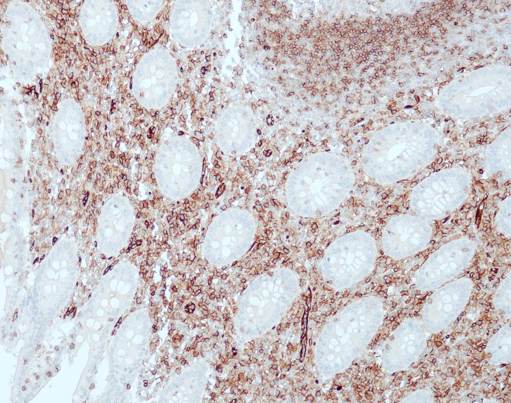 CD31 (QR034) 0,1 ml konsentraatti