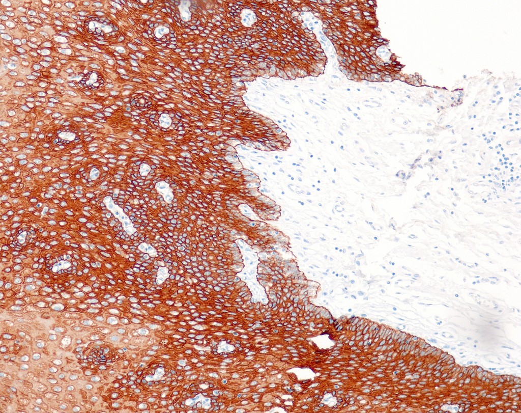 Cytokeratin HMW (34betaE12) 0,5 ml konsentraatti