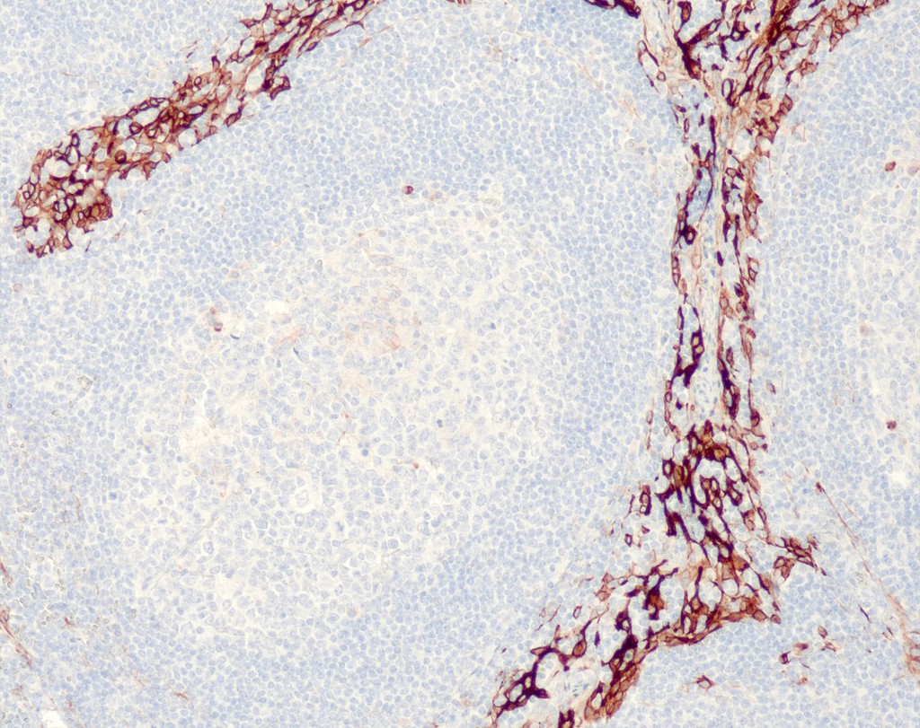Cytokeratin 8 (QR112) 3 ml RTU liuos
