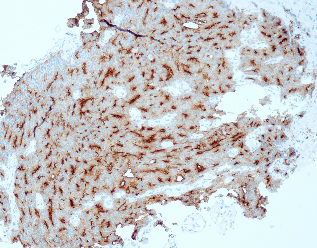 PSMA (QR079) 7 ml RTU liuos