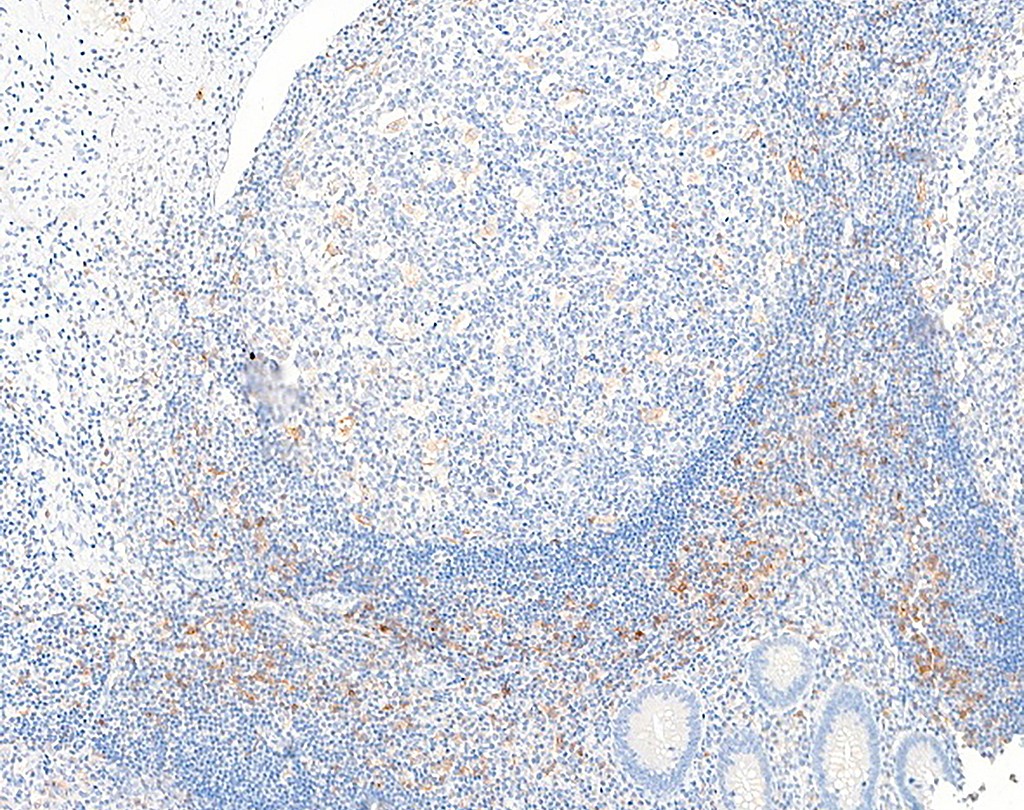 CD25 (QR171) Rb 0,5 ml konsentraatti (RUO, Research Use Only)