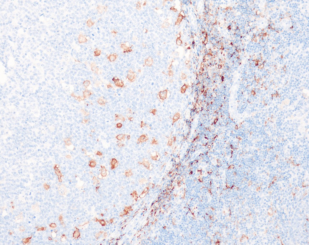 CD163 (QR162) Rb 0,1 ml konsentraatti (RUO, Research Use Only)