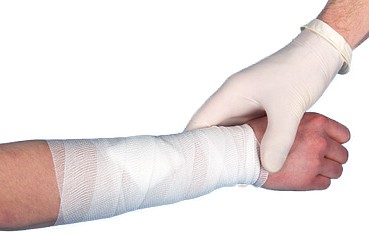 Nobafix elastinen harsosiderulla kääreetön 4 cm x 4 m