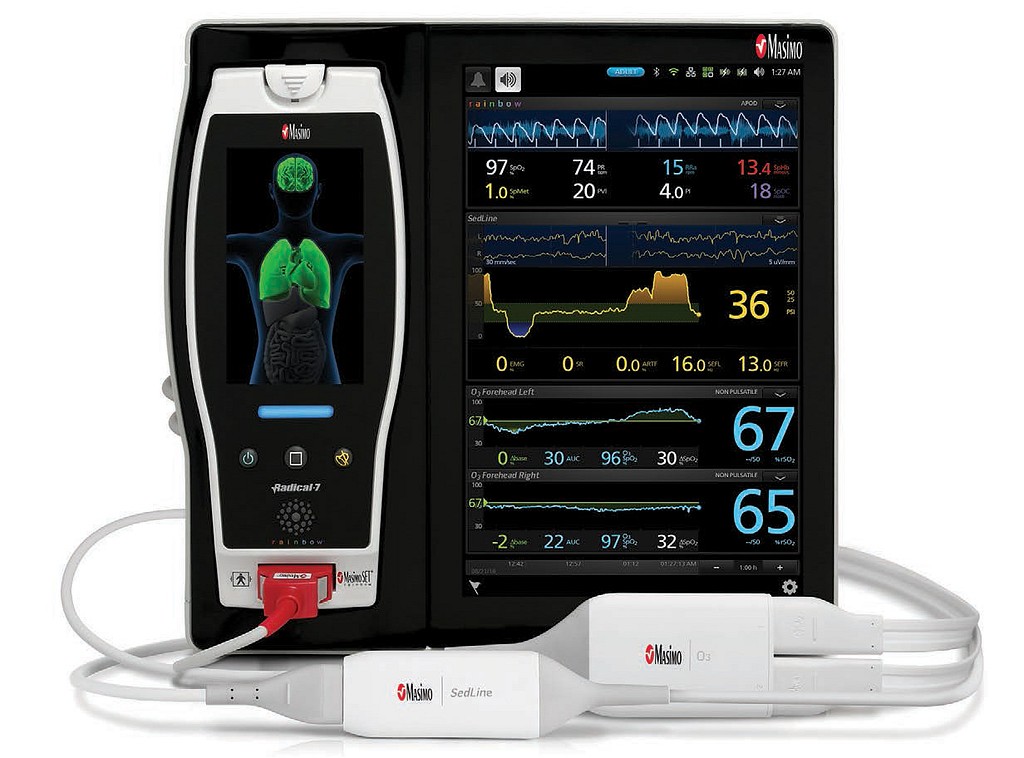 Masimo Root monitori