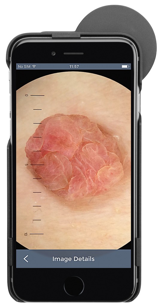 HEINE iC1 digit dermatoskooppisetti iPhone 7/8