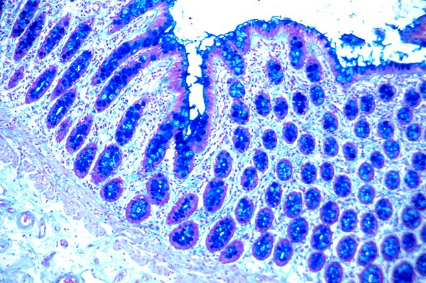 Colloidal Iron -osoitusvärjäyskitti