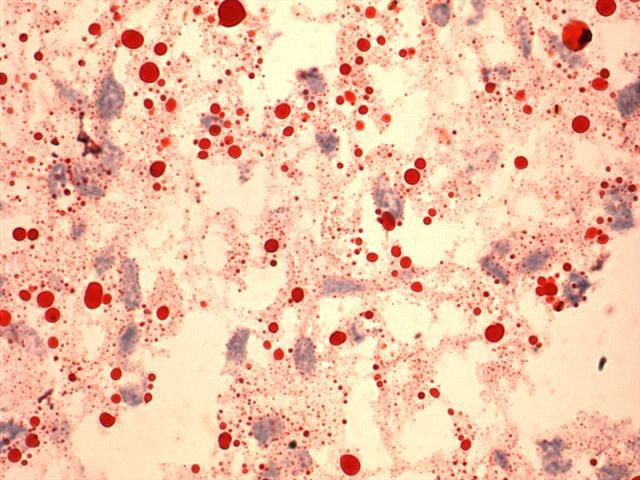 Oil Red O -osoitusvärjäyskitti