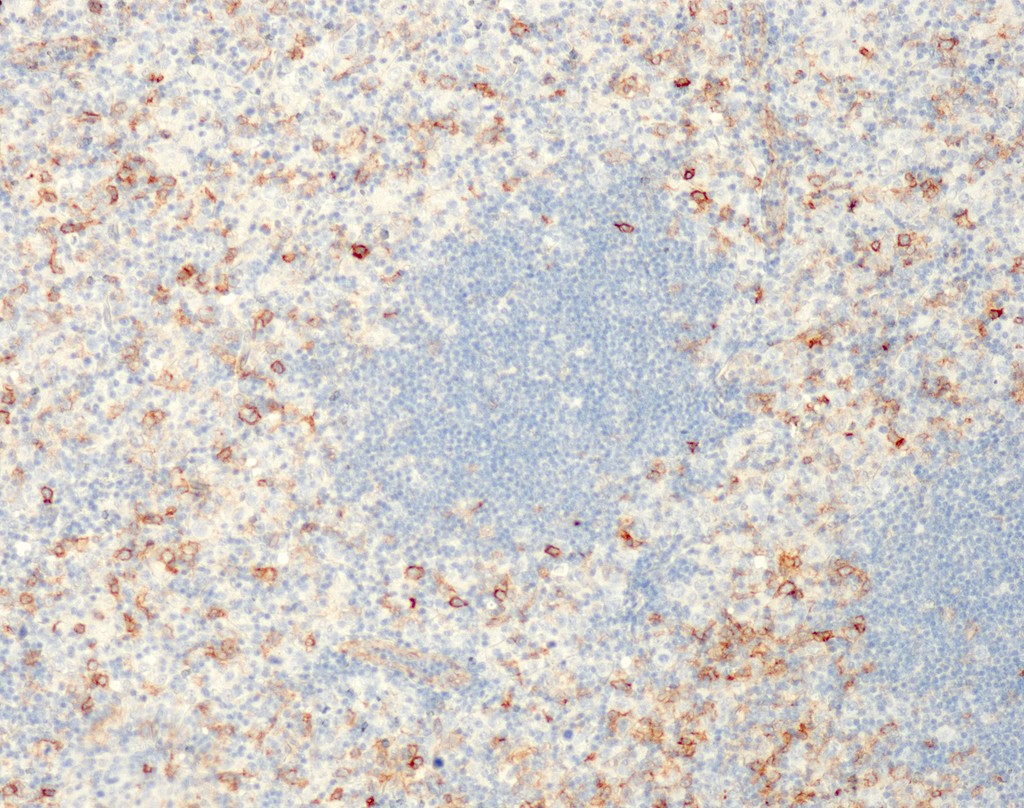 IRTA1 (QM005) Rb 0,5 ml konsentraatti