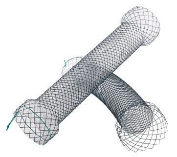 Taewoong Pyloric/Duodenal stent 22mm/6cm