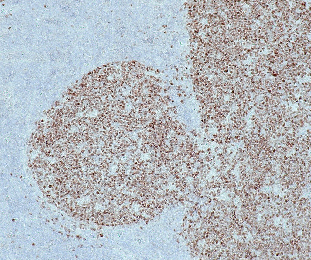 Bcl-6 (QR047) Rb 0,5 ml konsentraatti