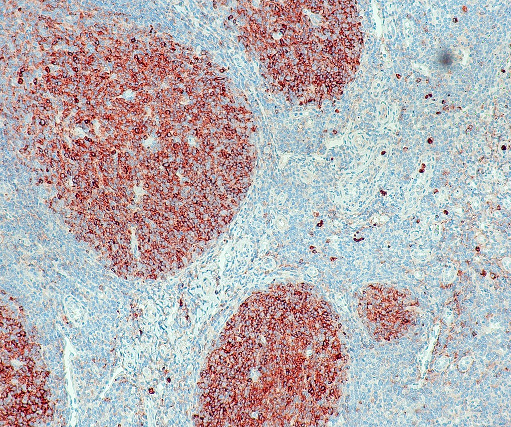 CD10 (QR021) Rb 0,5 ml konsentraatti