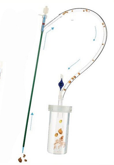 Ureteral Access Sheath, 11-13 Fr x 36cm