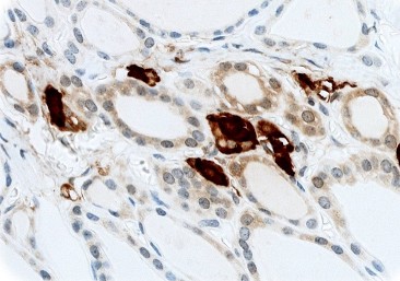 Calcitonin polycl. Rb 0,1 ml konsentraatti
