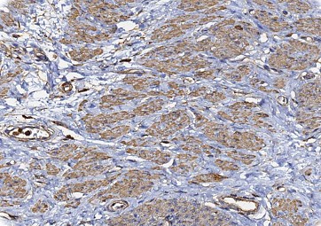 Actin, smooth muscle (1A4) Ms 0,5 ml konsentraatti