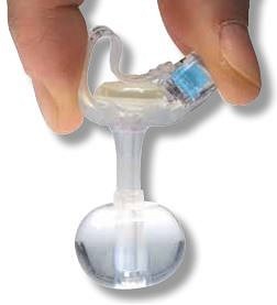 Minione Gastrostomiport Set 1 St 14fr 1,2cm Lev Art M1-5-1412-I