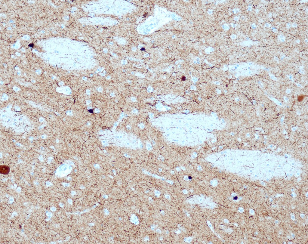 Calretinin (QR059) 0,1 ml konsentraatti