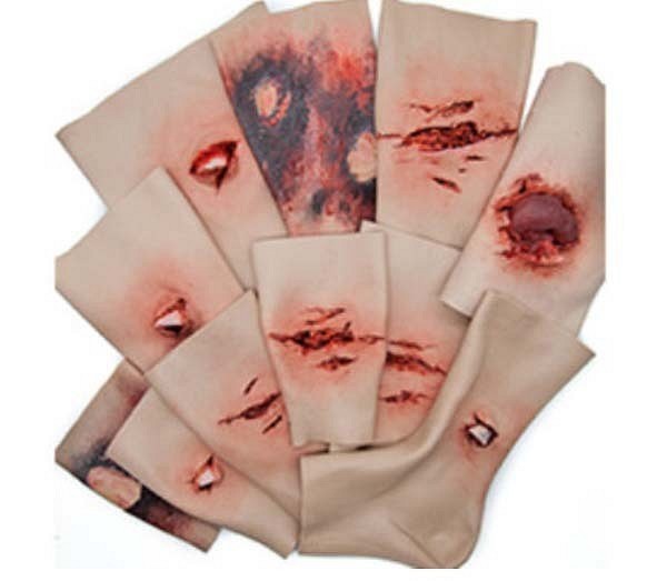 Trauma FX - Simsleeve - Thigh - Open Fracture