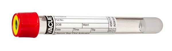 Vakumrør Vacuette serum gel 5ml rød/gul u/skru