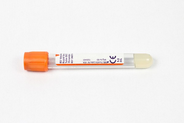 Vakuumrör BD Vacutainer Rapid, 7/5 ml, orange, pappersetikett