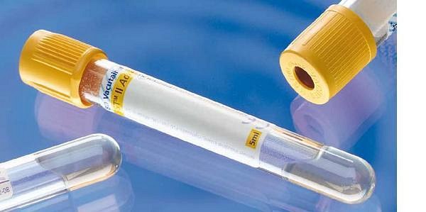 Vakuumrör BD Vacutainer SST II, 5/3,5 ml, gel, gul, pappersetikett