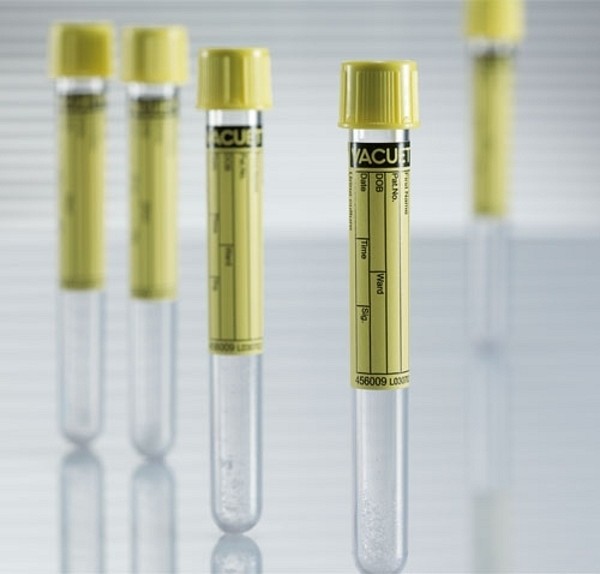 Vakuumrör Vacuette Urin CCM, stabilisator, 5/4ml, gul, pappersetikett