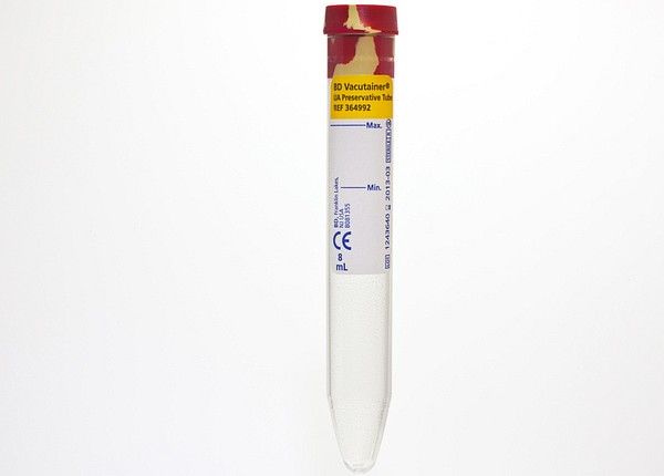 Vakuumrör BD Vacutainer Urin, stabilisat, 10/8 ml, gul/röd, pappersetiket