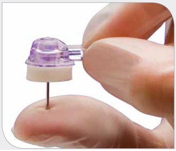 Venportsnål Gripper Micro 0,7x19mm. Steril, stickskyddad, latexfri
