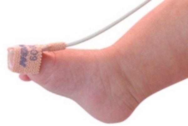 Pulsoximeter sensor nonin infant engångs