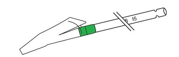 Sugkateter Vacutip rak 28,5cm ch6 steril vakuumkontroll