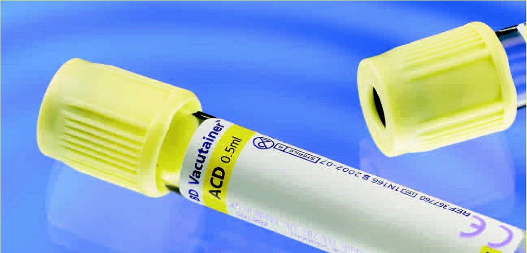 Vakuumrör BD Vacutainer 10/8,5ml ACD lösn A, gul glas pappersetikett
