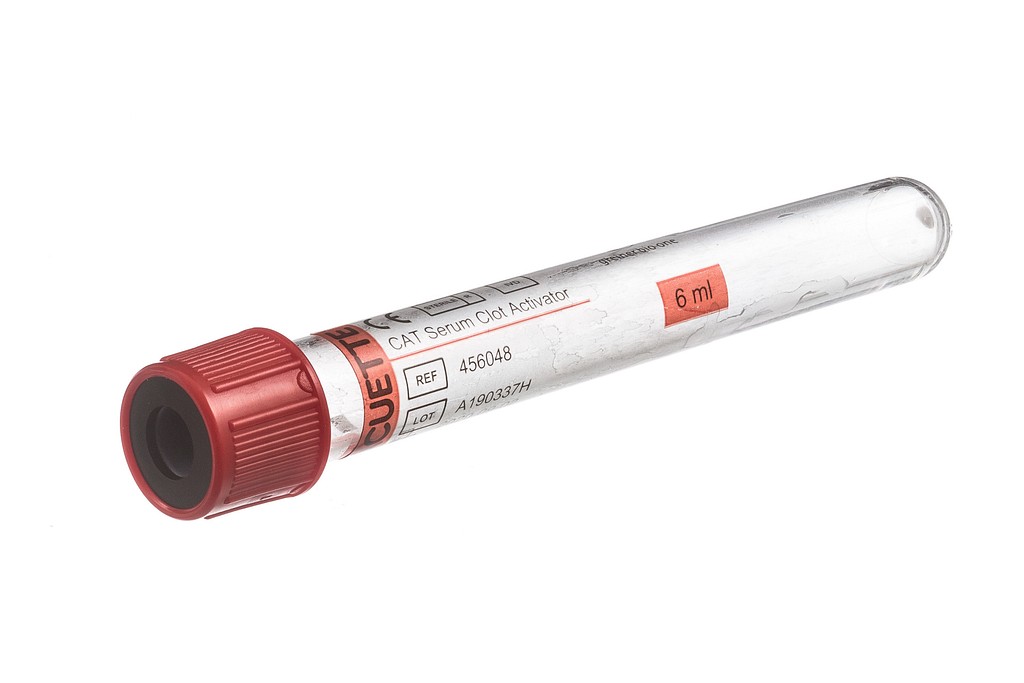 VACUETTE TUBE 6 ml CAT Serum Clot Activator